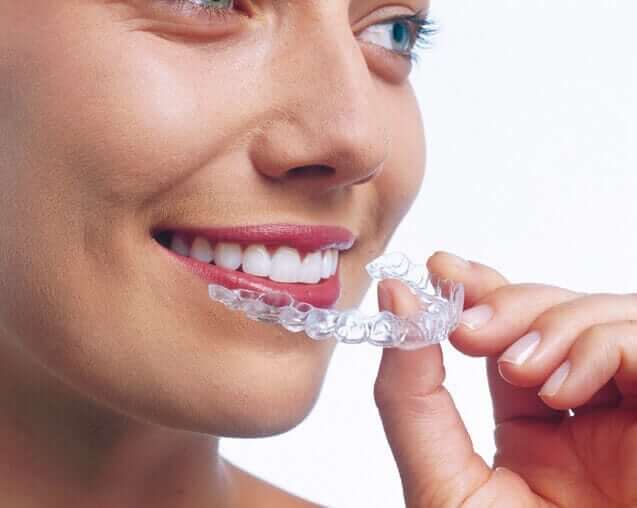 Ortodoncia Invisible con Invisalign